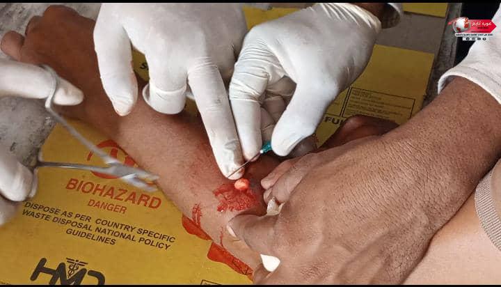 الدكتور محمد سفيان الحوشبي ينجح في إجراء عملية جراحية لمدير مستشفى المسيمير